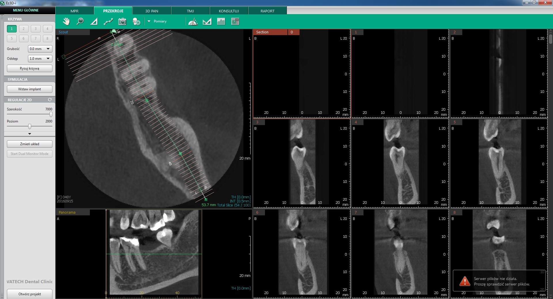 rtg-ostrowskiego-tomografia-5×5-przekroje